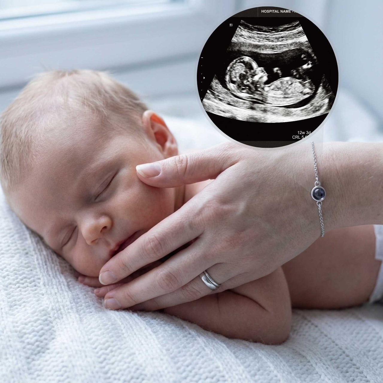 Photo Projection Bracelet - From Ultrasound to Forever